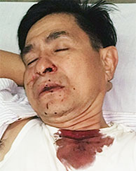 Quang injured